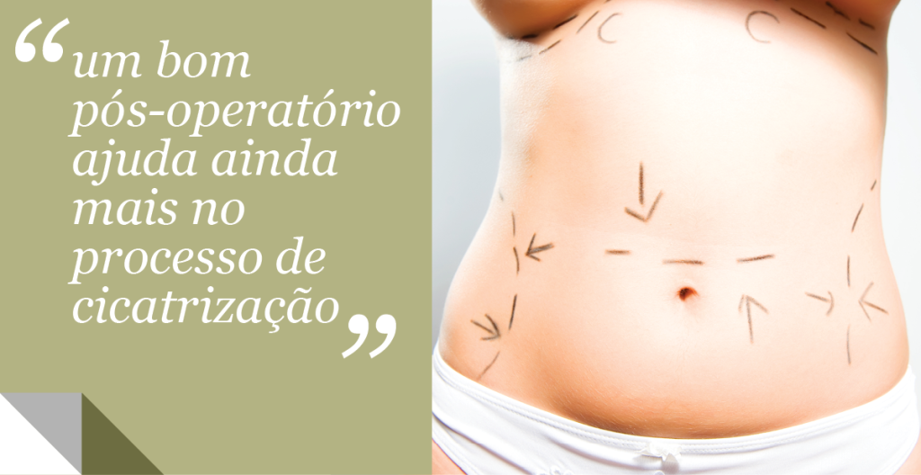 Lipoaspiração pos operatório