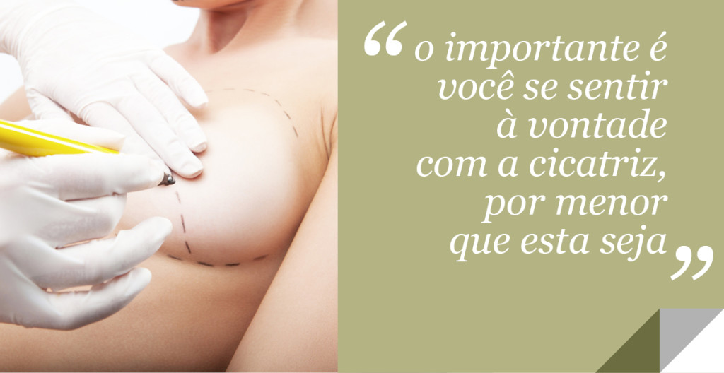 cicatriz - mamoplastia com protese