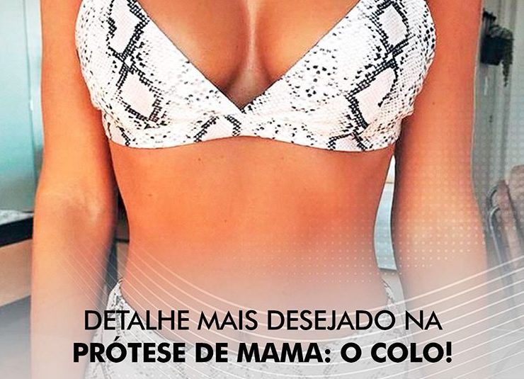 colo cirurgia de mamas rio de janeiro