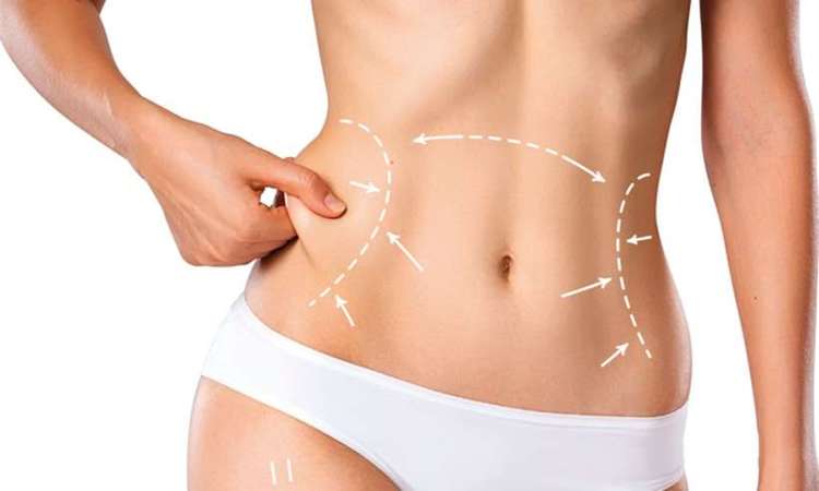 lipo hd no abdomen rio de janeiro