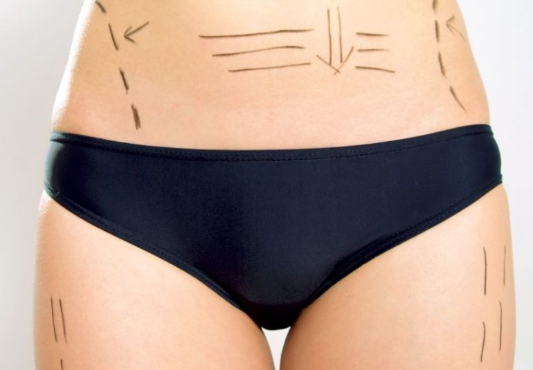 cirurgia plástica no rio de janeiro