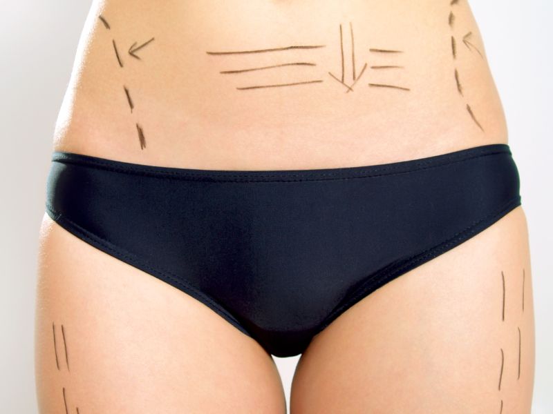 cirurgia plástica no rio de janeiro